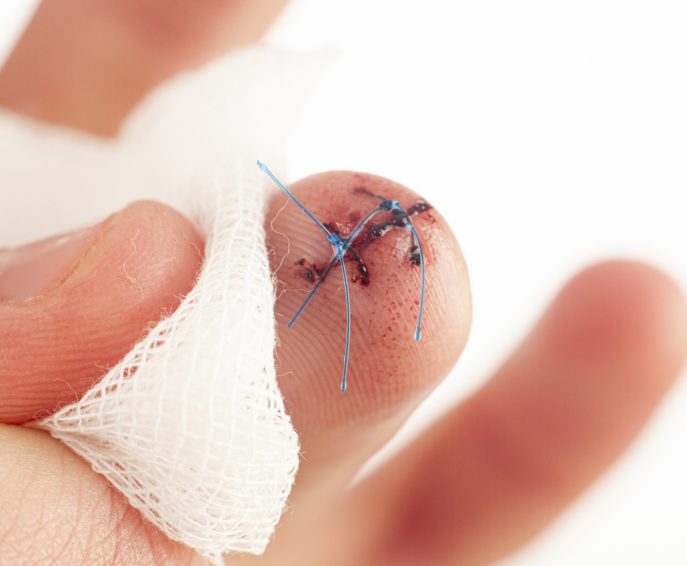 RETRAIT DE POINTS DE SUTURE OU AGRAFES ET PANSEMENTS