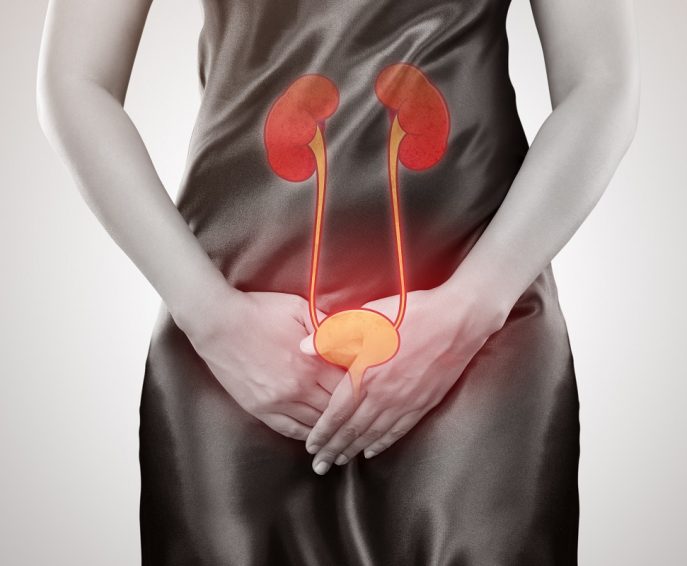 Dépistage de l’infection urinaire chez la femme